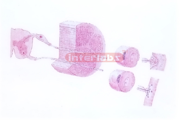 STRUCTURE MODEL OF PERIPHERAL NERVE